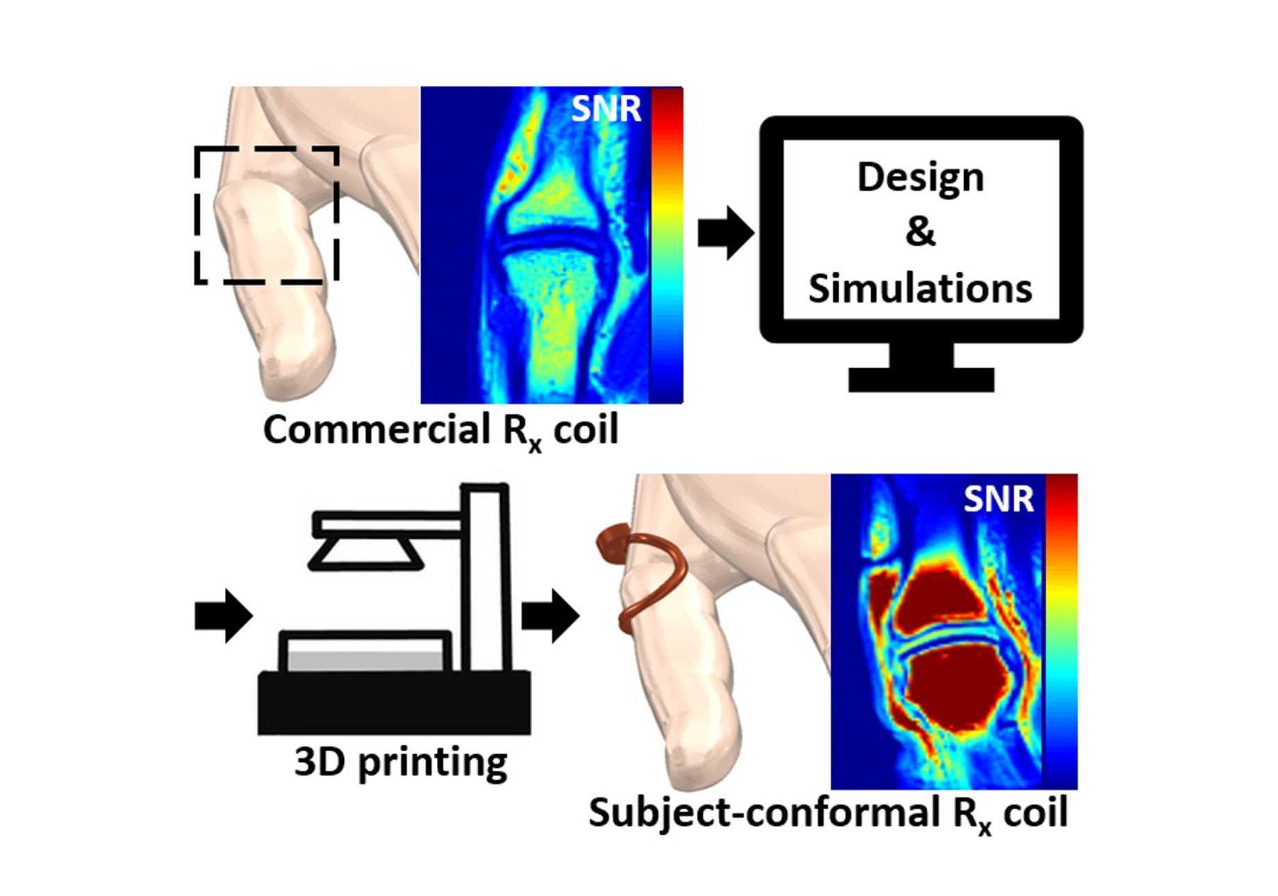 Additive Manufacturing of Subject-Conformal Receive Coils for MRI @Adv. Mat. Tech.!